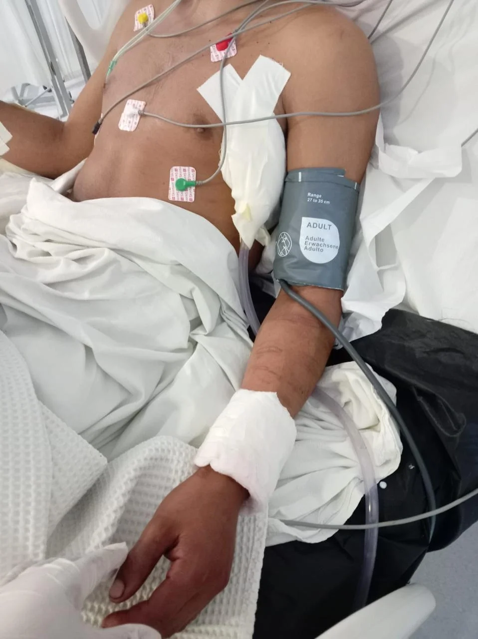 Joven apuñalado en Paque Virrey INTERNADO