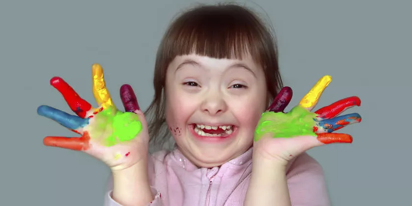 sindrome-de-down