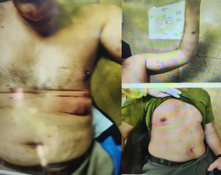 Paquete Bomba Ministerio de Seguridad 20260220 (03)